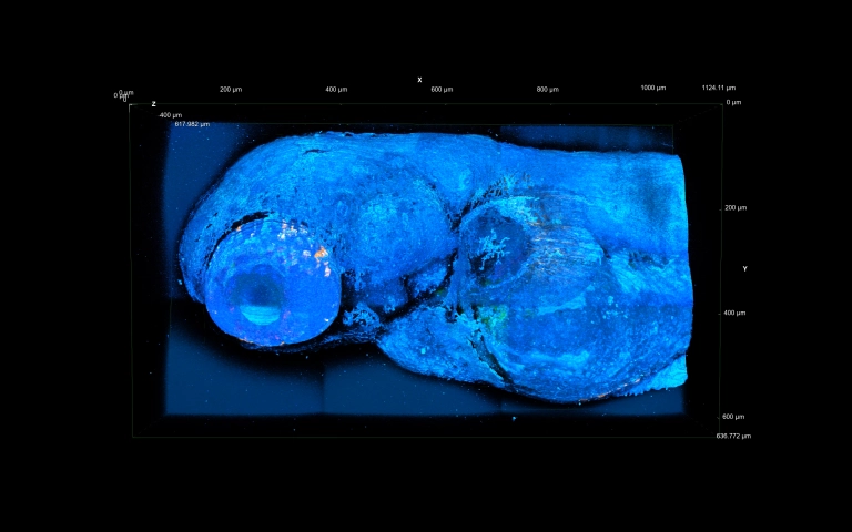 Nonlinear microscopy in biological tissues